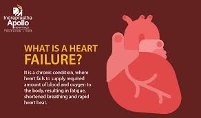 Heart attack and sudden cardiac arrest are not the same — and knowing the signs of each may save your life. What Is The Difference Between Heart Failure And Heart Attack Blog Delhi Apollo Hospitals