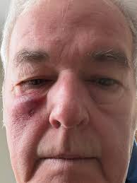 Do I need a travel adapter for electronic devices in Mexico?