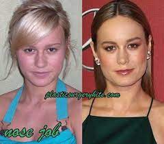 Many actresses and celebrities take this . Brie Larson Plastic Surgery Before And After Nose Job Plastic Surgery Brie Larson