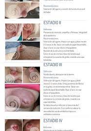 Infeccion Pezon Archivos La App De Lactancia Materna Mas Completa Y Personalizada Lactapp