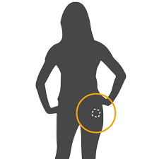 Image result for Contraceptive Patch