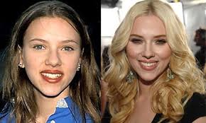 What's it like to go from being unattractive to gorgeous? 10 Celebrity Plastic Surgeries Gone Good Indiatoday