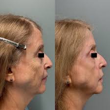 John Kamran Nia, MD (@jknmd) • Instagram photos and videos