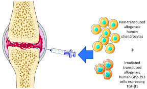 Read light novel, web novel, korean novel and chinese novel online for free. The Intra Articular Injection Concept For Tissuegene C A Novel Cell Download Scientific Diagram