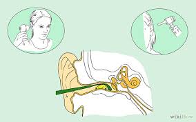 If your problem isn't serious, but you do feel like you have too much earwax buildup, you can gently clean the outside of your ears. How To Clean Out Your Ears Properly Remove Ear Wax According To Ent Healthy Food House