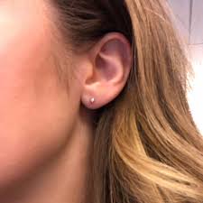 It isn't a perfect way, and it's not highly it depends on the size of the hole, you saying that you. What It S Like Getting Earlobe Repair Surgery