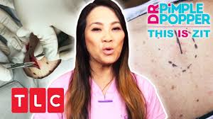 I am addicted to dr. This Is Zit Riesiges Lipom Auf Der Schulter Dr Pimple Popper Tlc Deutschland Youtube