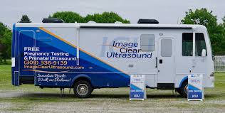 If you want to learn more about your pregnancy and ensure you're making healthy choices, schedule your free pregnancy test and ultrasound. Mobile Unit Living Alternatives