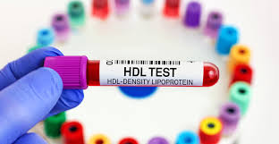 HDL cholesterol cardioprotective role questioned - Hospital Pharmacy  EuropeHospital Pharmacy Europe