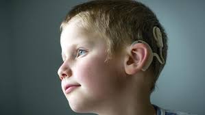 Cochlear hears great call of China