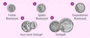 Was musst du beachten oder vermeiden? Embryobewertung Nach Entwicklungstag Grading
