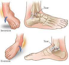 Get lali meaning in english at best online dictionary website. Hsc Medical Center