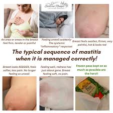 Image result for Mastitis