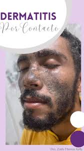 🟣 DERMATITIS POR CONTACTO , ⚠️Imagína presentar estos síntomas en el  rostro u otra parte del cuerpo y ¡no saber que hacer!, 💜¿Qué es la  Dermatitis por Contacto? , Es una afección por la que la piel ...