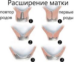 Kak Ponyat Chto Nachalis Shvatki I Rody Oshusheniya Kak Nachinayutsya Shvatki Detskaya Stomatologicheskaya Poliklinika G Penza