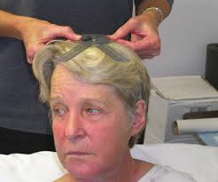 LYMPHEDEMA TREATMENT FOR THE HEAD AND NECK ONCOLOGY PATIENT