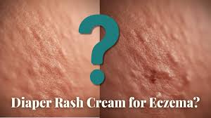 Image result for diaper dermatitis