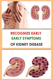 Recognize Early Symptoms Of Kidney Disease Kidney Disease Symptoms Kidney Cleanse Natural Kidney Disease