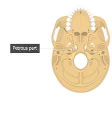 Image result for Temporal Bone