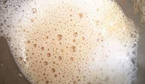 Doesn't it seem like these days that there are 100+ different cleaning product available for just the bathroom? Bubbles In The Urine Causes Symptoms And Treatment