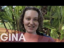 Gina — FFS Surgery Stories