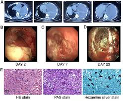 Image result for Amphiasma