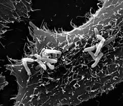 Image result for Rhodococcus equi