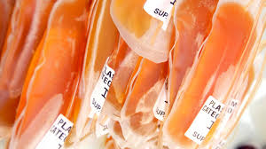 Image result for Plasma Transfusion