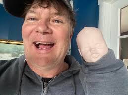 It started as a wart