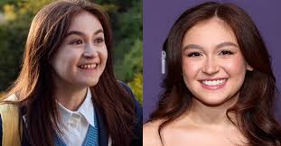 Anna Cathcart Teeth: Her Stunning Smile Transformation