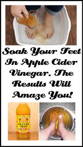 Soak Your Feet In Apple Cider Vinegar The Results Will Amaze You Apple Cider Vinegar Apple Cider Organic Apple Cider Vinegar