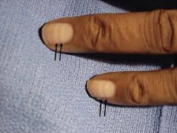 Image result for Mees Line