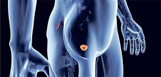 Reviews common tests for these conditions, as well as treatment side effects. Diagnostik Lasst Sich Stark Verbessern