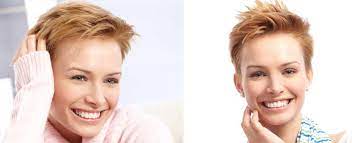 These many pictures of hairstyles for thinning hair due to chemo list may become your inspiration and informational purpose. Styling Tips For Hair Growth After Chemo