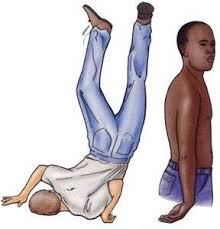 Check spelling or type a new query. Erb S Palsy Diagnosis Causes Symptoms Treatment Exercise