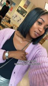 Itati Teeth Before Getting Braces