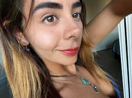 Baby born without nose has new nose now