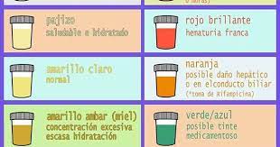 El Color Normal De La Orina Depende Directamente De La Ingesta De Liquidos A Mayor Ingesta Mas Clara Es La Orina A Menor Ingesta Mas Conc Medicine Health Nurse