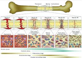 Most vertebrae in your thoracic spine connect to your ribs, making this part of your spine relatively stiff and stable. Illustration Of A Typical Fracture Healing Process Biological Events Download Scientific Diagram