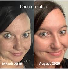 Hi everyone I'm starting to stop wearing makeup as it's bad for my skin.  I'd like to get a facial done and be recommend good face care products does  anyone know anyone