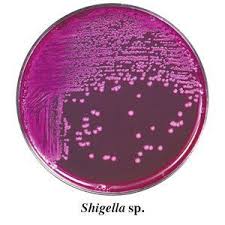 Image result for Shigella