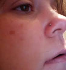 Getting Nose Re Pierced After First Nose Stud Fell Out In The Shower Nose Piercing Nose Stud Nose