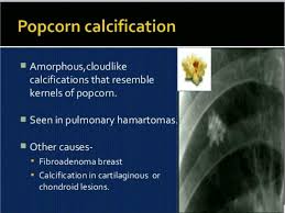 Pin By Msradiology On Radiologia Torax Medical Mnemonics Radiology Science Biology