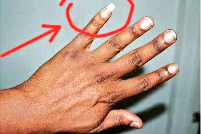 Why Do Some People Keep One Fingernail Long? The Surprising Reasons Behind  the Habit
