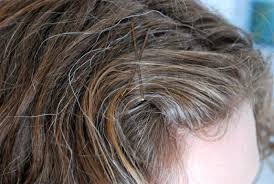 According to research, a vitamin b12 deficiency or problems with your pituitary or thyroid land. Premature Greying Hair Treatment Signs Symptoms Dr Bagadia S