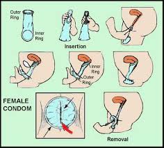 Among the many barrier methods of birth control, the condom for men is used most often. I Ve Heard S S P P