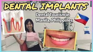 Free dental grants for single mothers. Dental Implants Cost Procedure Before And After Manila Philippines Dental Tourism English Sub Youtube