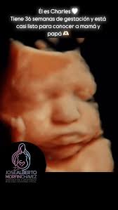 ¡ Hola Charles ! , Ya falta muy poco para conocerte pequeño 🫶🏻,  👨🏻‍⚕️Dr. José Alberto Morfín, #Ginecología #Obstetricia  #MedicinaMaternoFetal, 📱WhatsApp: 331 256 6786, 🏥 Torre Mommy, Av. Niño  Obrero ...