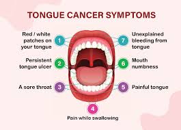 Image result for cancer tongue symptoms)