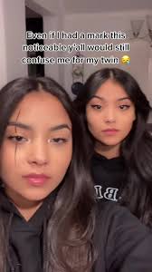 MyKa Montoya: Embracing Birthmarks